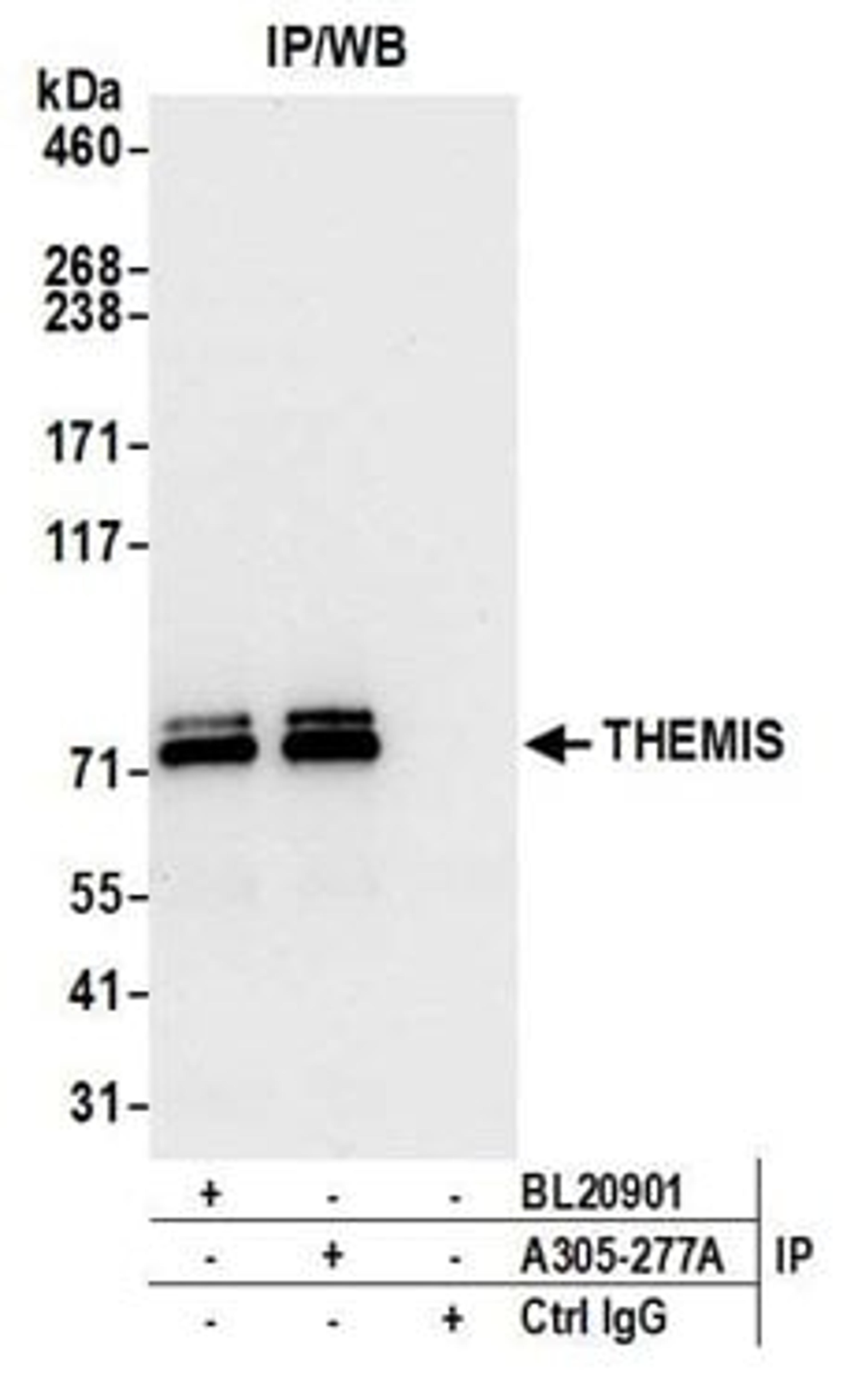 Detection of human THEMIS by western blot of immunoprecipitates.