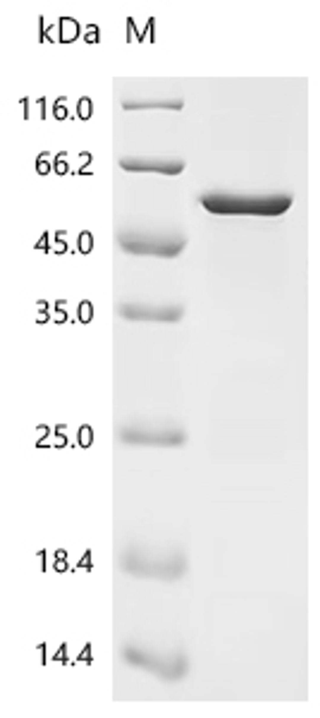 (Tris-Glycine gel) Discontinuous SDS-PAGE (reduced) with 5% enrichment gel and 15% separation gel.