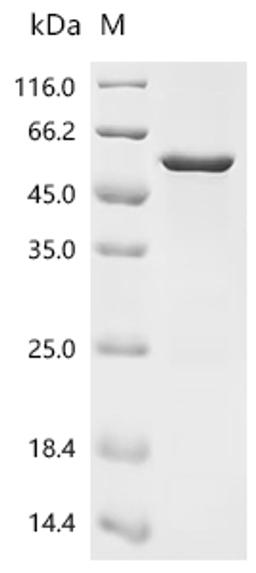(Tris-Glycine gel) Discontinuous SDS-PAGE (reduced) with 5% enrichment gel and 15% separation gel.