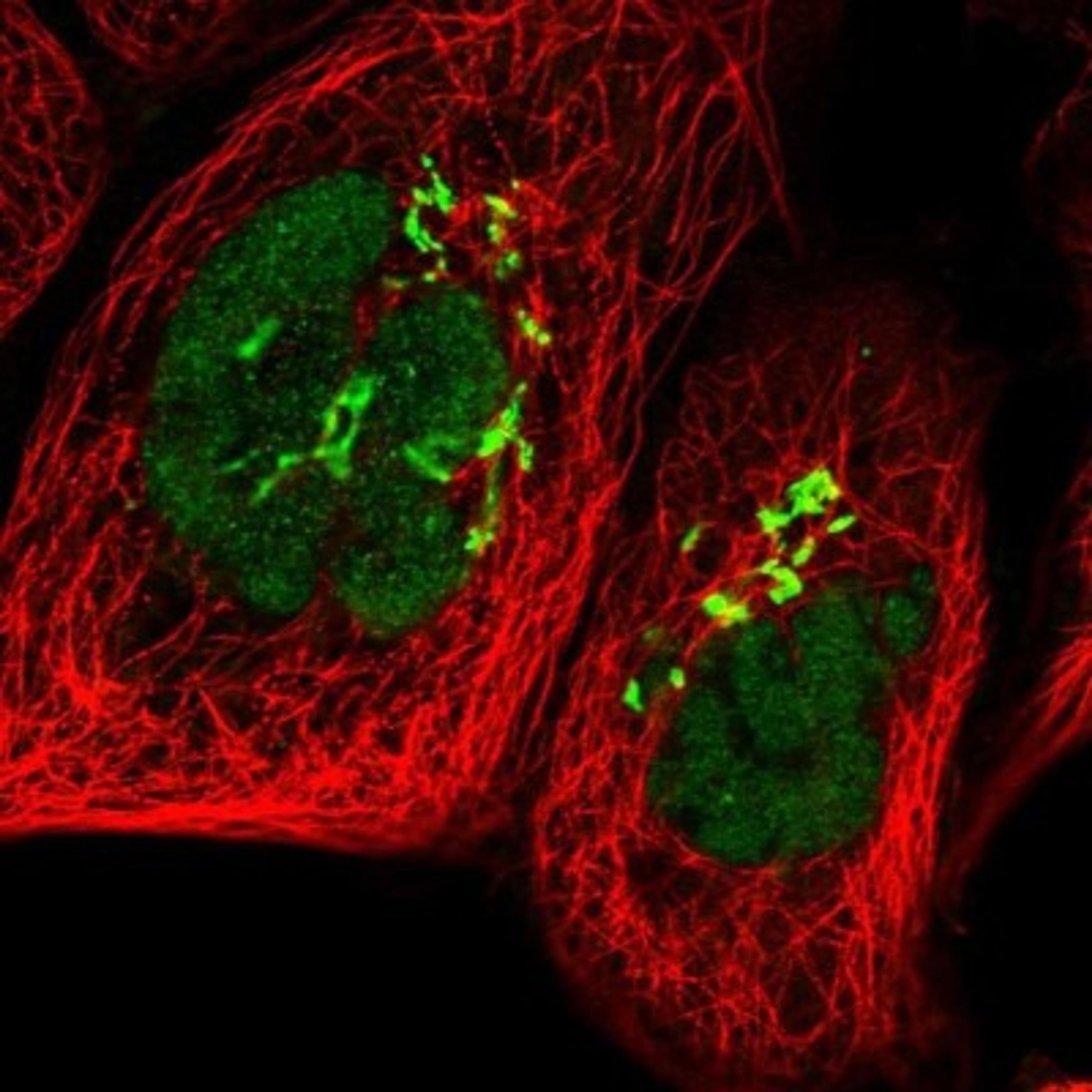 Immunocytochemistry/Immunofluorescence: POLR1D Antibody [NBP1-82655] - Staining of human cell line A-431 shows positivity in nucleus but not nucleoli & golgi apparatus.