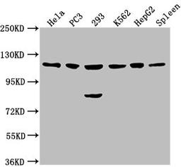 Western Blot. Positive WB detected in: Hela whole cell lysate, PC3 whole cell lysate, 293 whole cell lysate, K562 whole cell lysate, HepG2 whole cell lysate, Rat spleen tissue. All lanes: CDKL5 antibody at 1:2000. Secondary. Goat polyclonal to rabbit IgG at 1/50000 dilution. Predicted band size: 116, 108 kDa. Observed band size: 116 kDa. 