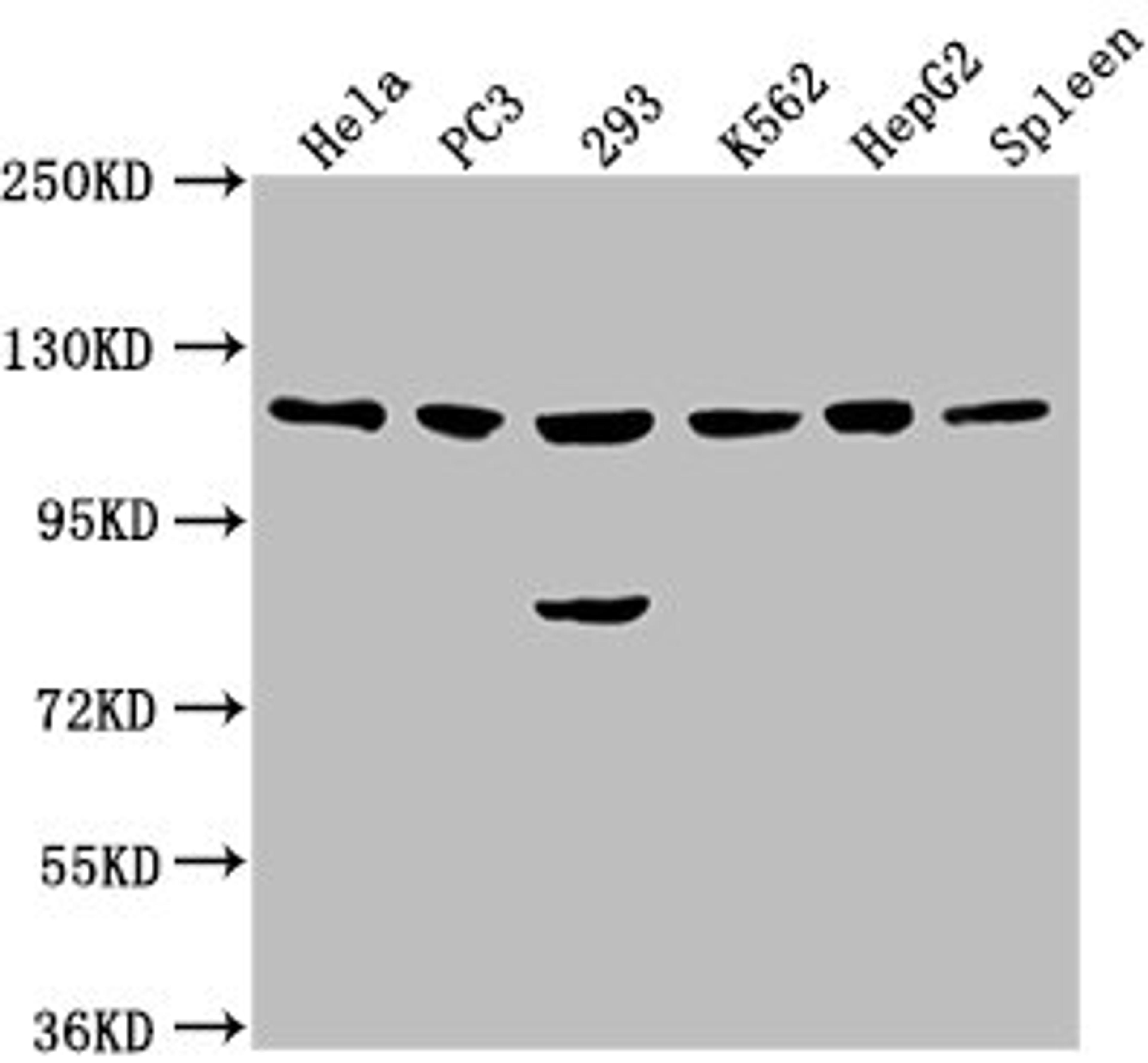 Western Blot. Positive WB detected in: Hela whole cell lysate, PC3 whole cell lysate, 293 whole cell lysate, K562 whole cell lysate, HepG2 whole cell lysate, Rat spleen tissue. All lanes: CDKL5 antibody at 1:2000. Secondary. Goat polyclonal to rabbit IgG at 1/50000 dilution. Predicted band size: 116, 108 kDa. Observed band size: 116 kDa. 