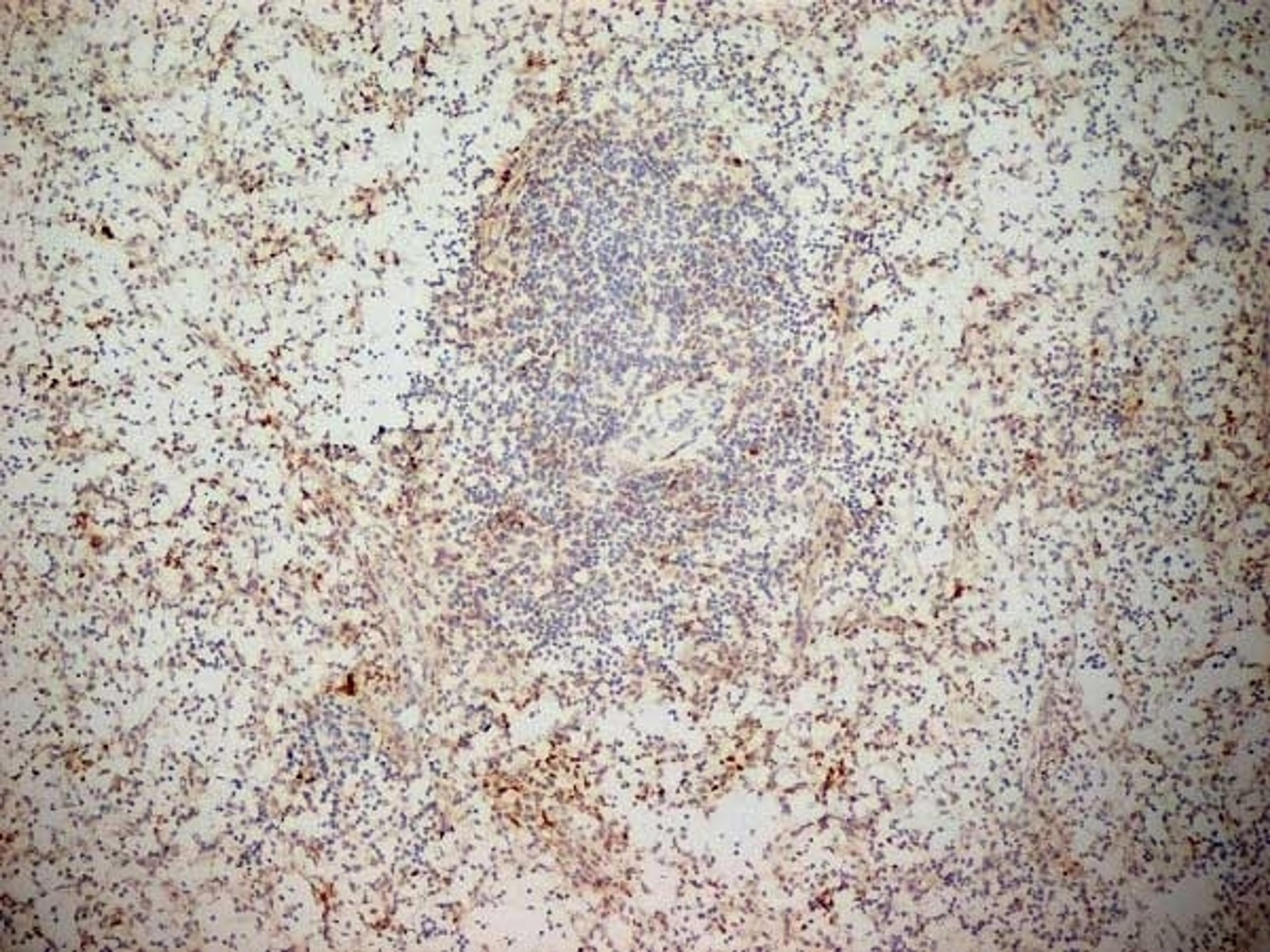 Immunoperoxidase staining of a human spleen cryosection with Mouse anti Human CD314 antibody