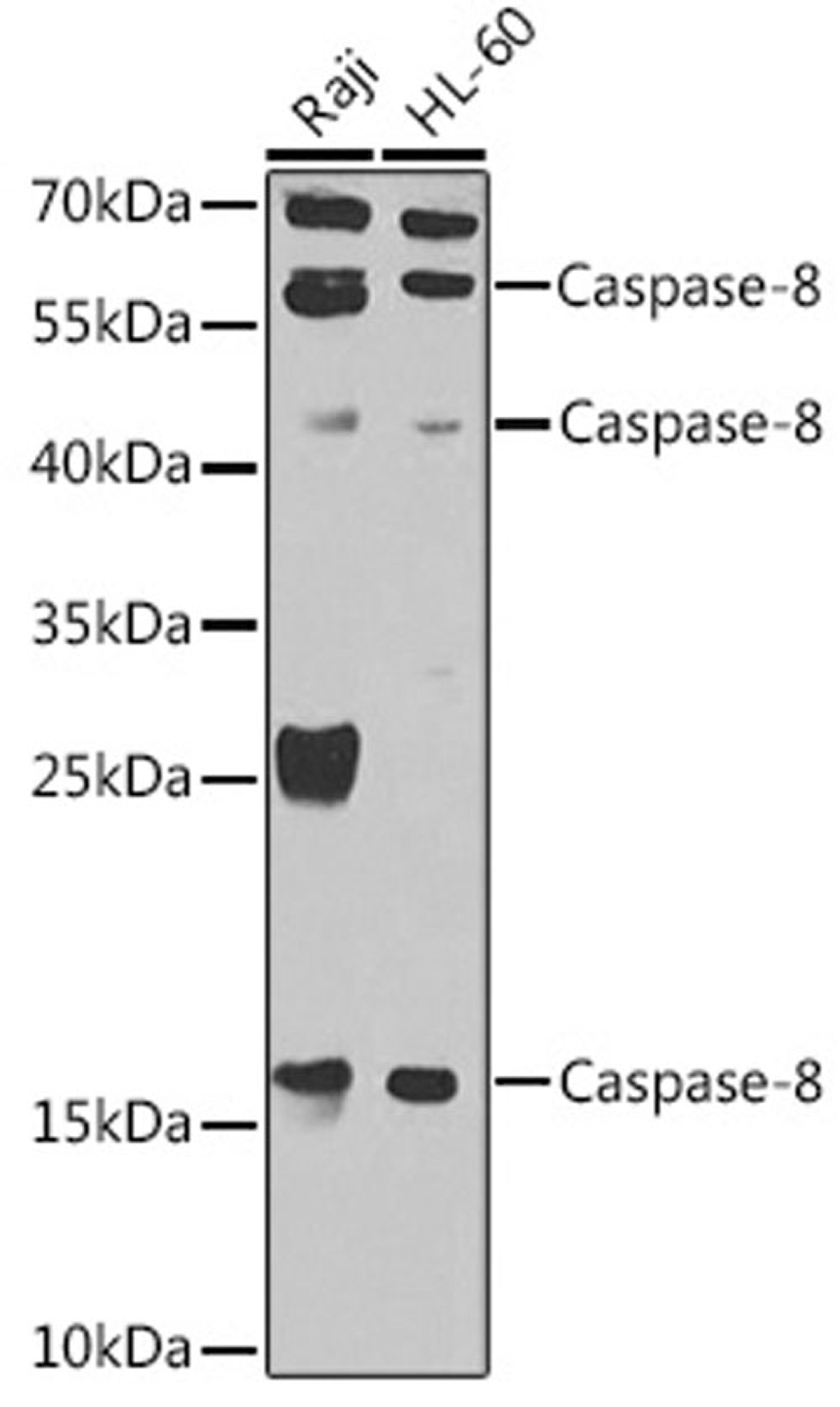 Western blot - Caspase-8 antibody (A0215)