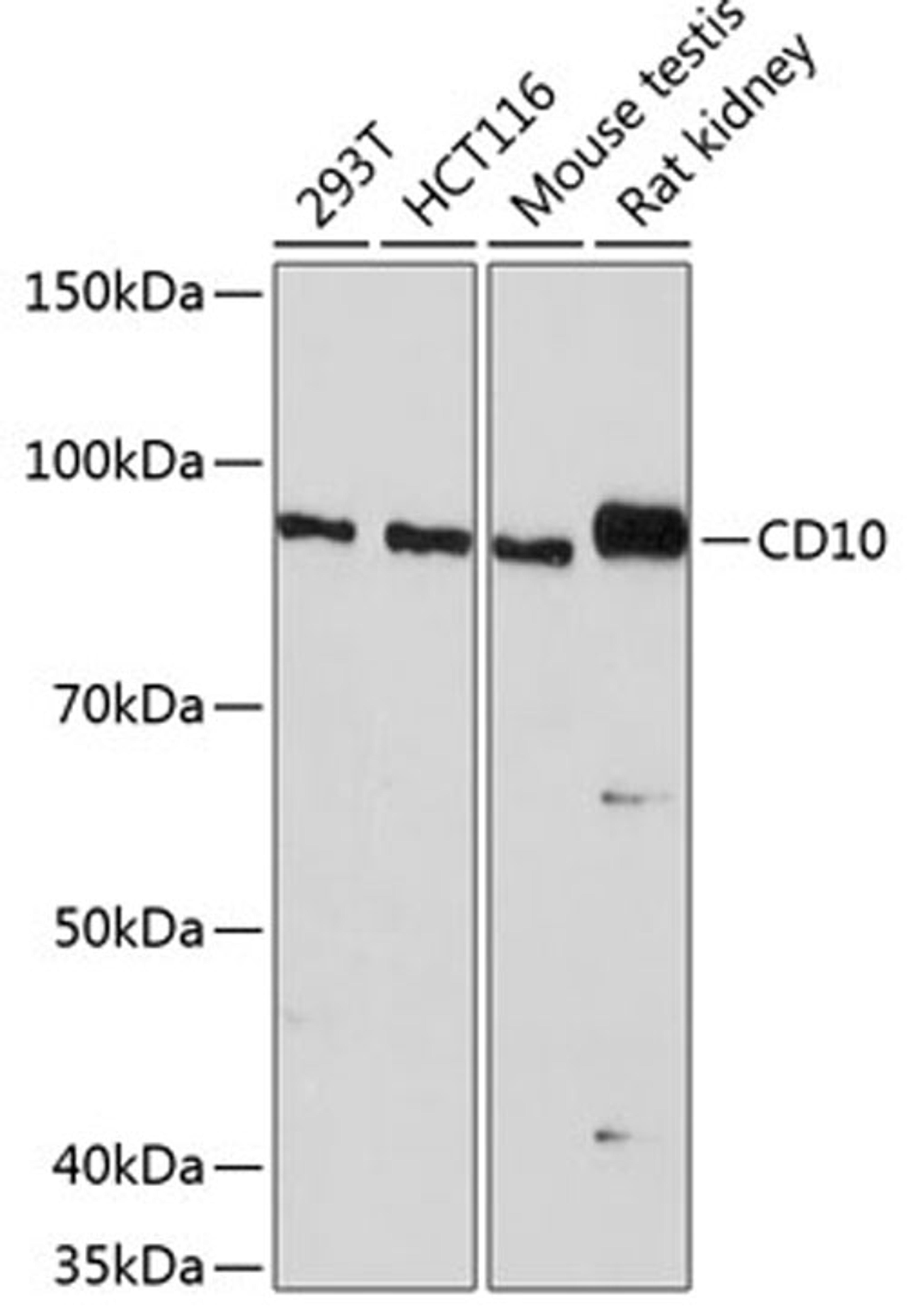 Western blot - CD10 antibody (A19007)