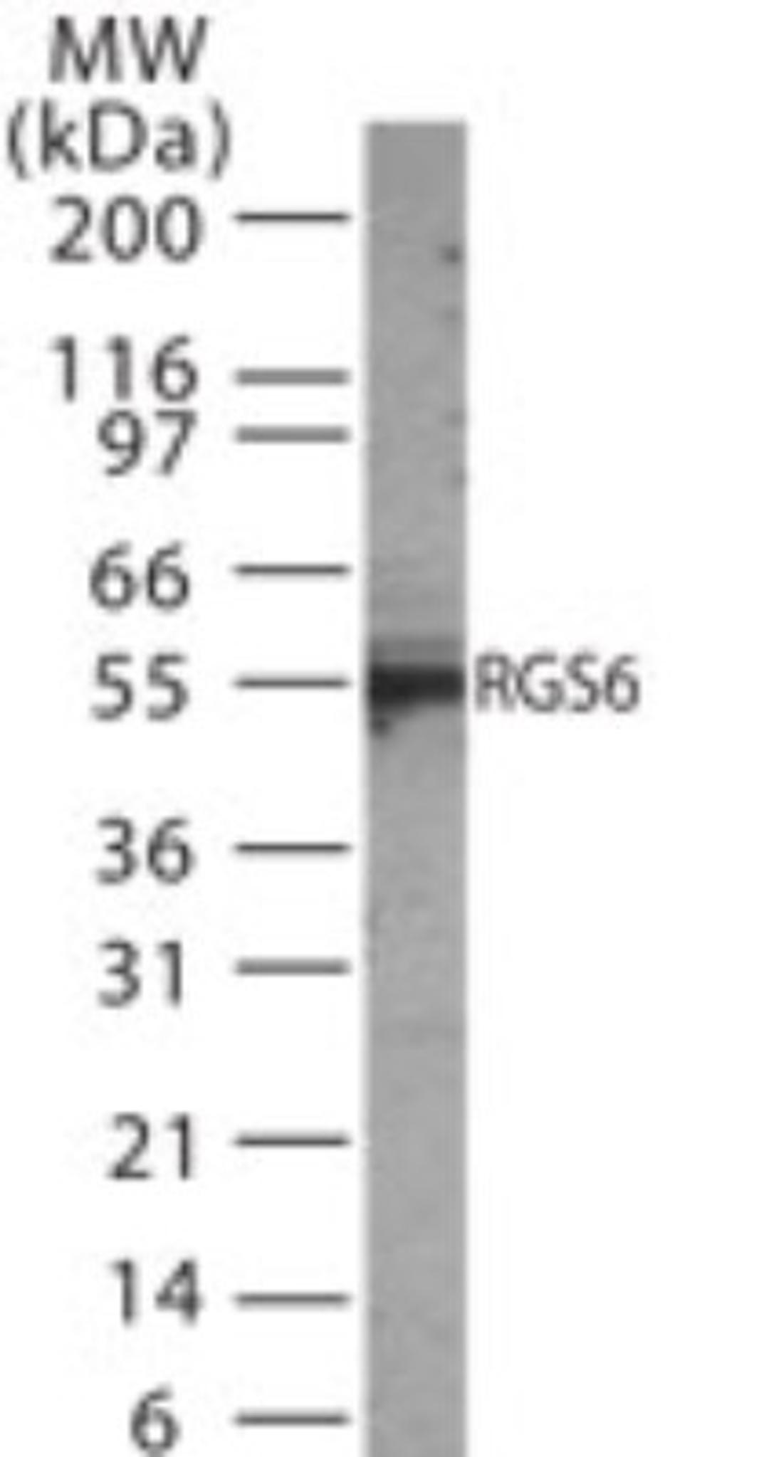 Western Blot: RGS6 Antibody [NB100-56659] - analysis of RGS6 in 30 ugs of mouse brain tissue lysate using this antibody.