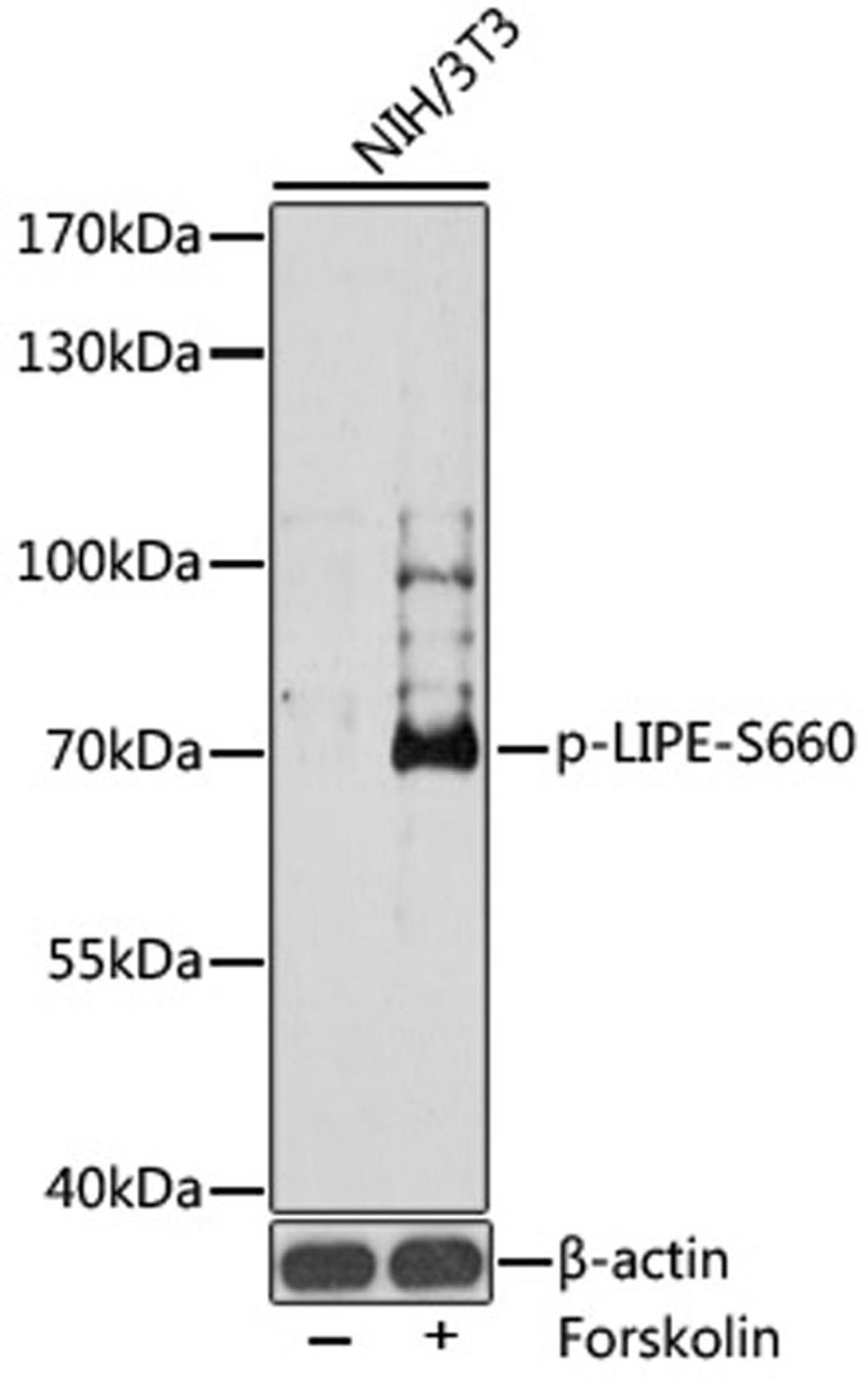 Western blot - Phospho-LIPE-S660 antibody (AP0853)