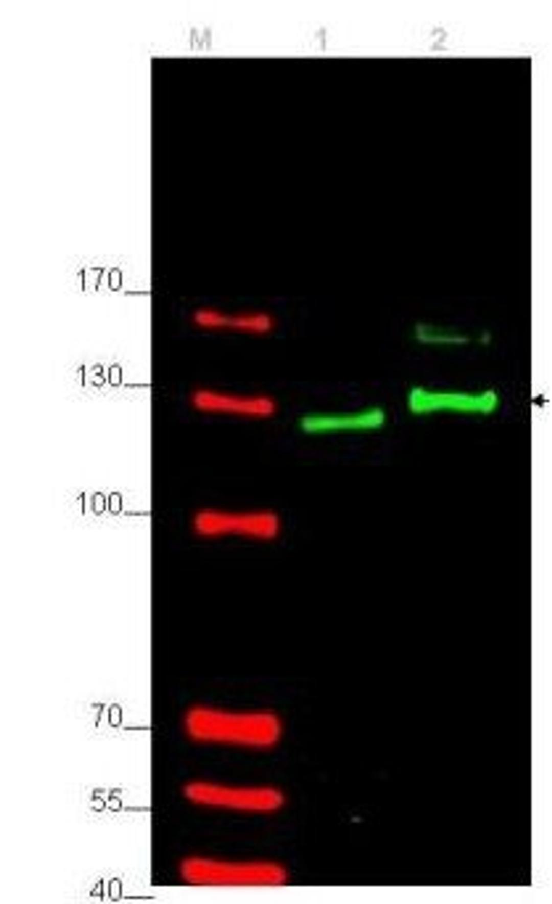 Western blot analysis of rat testes (lane 1) and human HEK293 (lane 2) whole cell lysates (arrowhead) using Gli-2 antibody