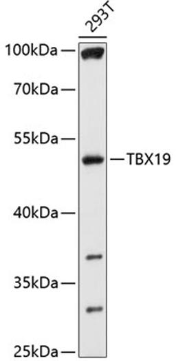 Western blot - TBX19 antibody (A10481)