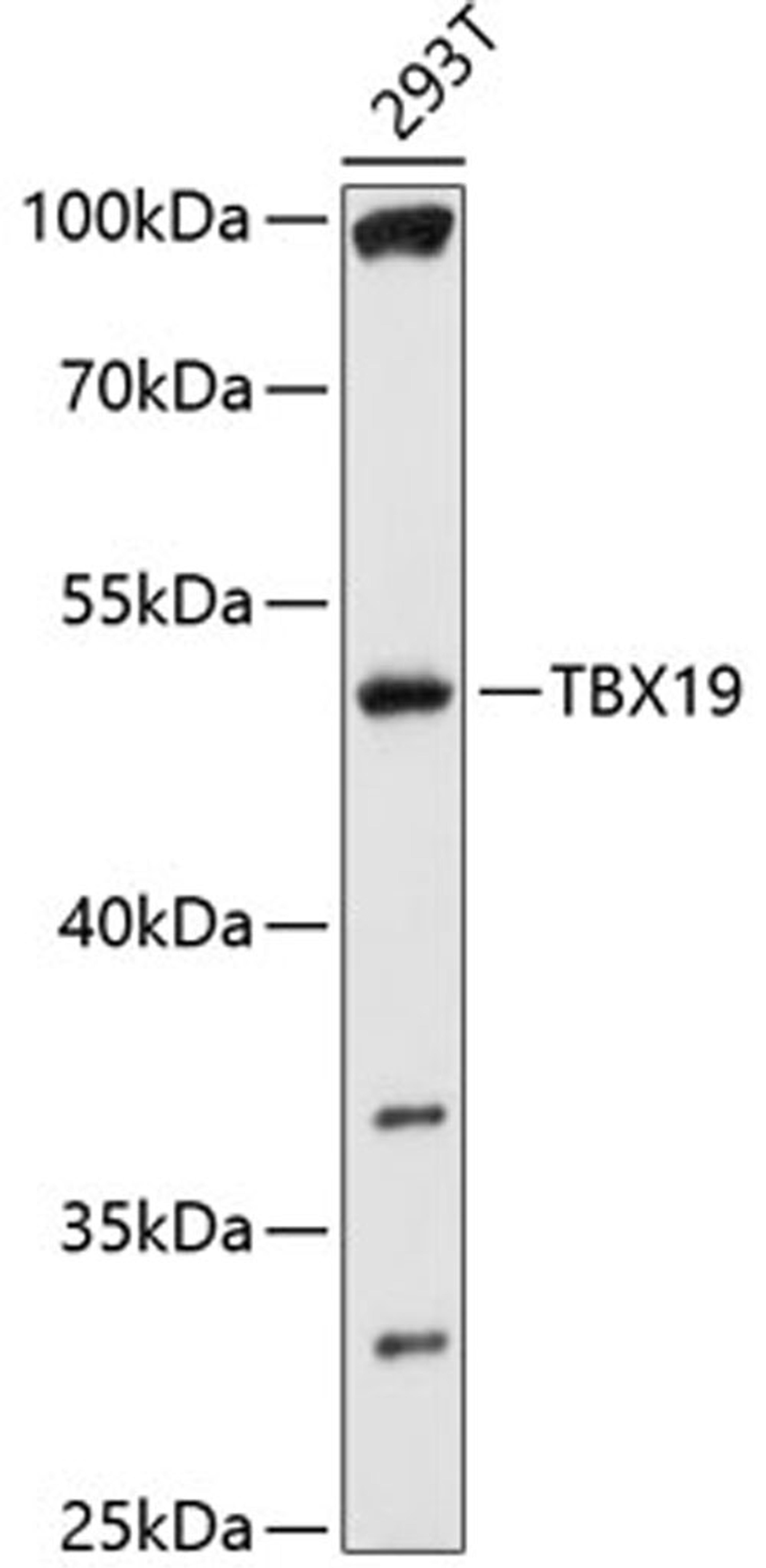 Western blot - TBX19 antibody (A10481)