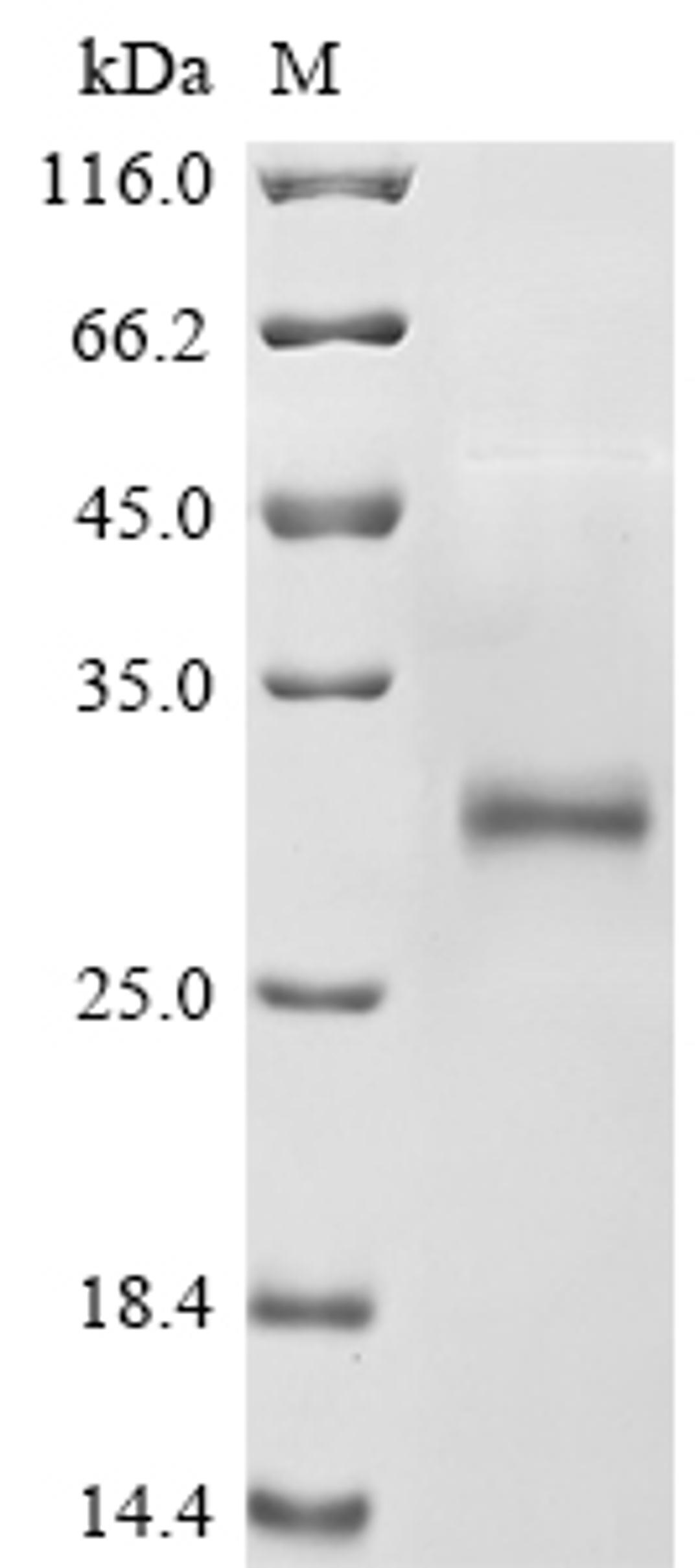 (Tris-Glycine gel) Discontinuous SDS-PAGE (reduced) with 5% enrichment gel and 15% separation gel.