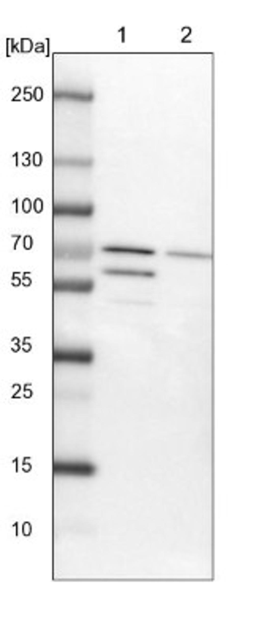 Western Blot: BTNL9 Antibody [NBP1-93875] - Lane 1: NIH-3T3 cell lysate (Mouse embryonic fibroblast cells)<br/>Lane 2: NBT-II cell lysate (Rat Wistar bladder tumour cells)