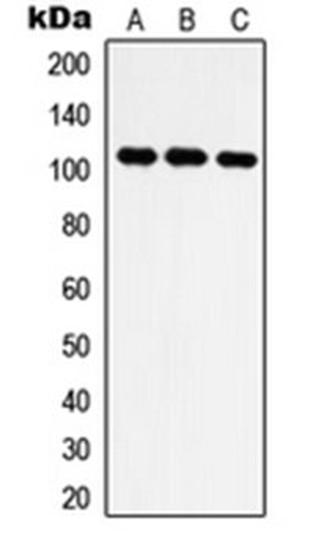 Western blot analysis of Jurkat (Lane 1), HT1080 (Lane 2), NIH3T3 (Lane 3) whole cell lysates using IARS2 antibody