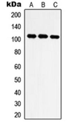 Western blot analysis of Jurkat (Lane 1), HT1080 (Lane 2), NIH3T3 (Lane 3) whole cell lysates using IARS2 antibody