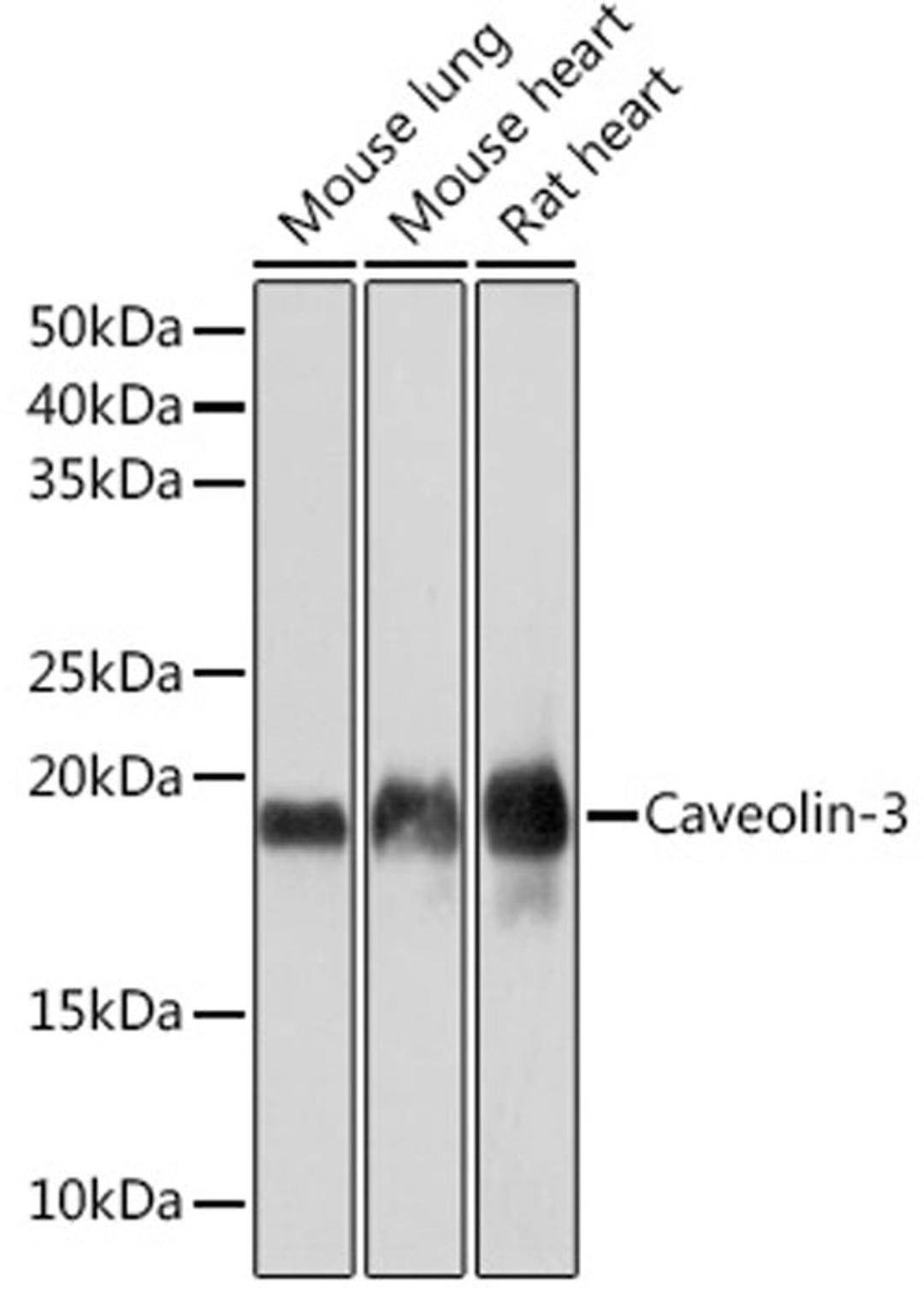 Western blot - Caveolin-3  Rabbit mAb (A4891)