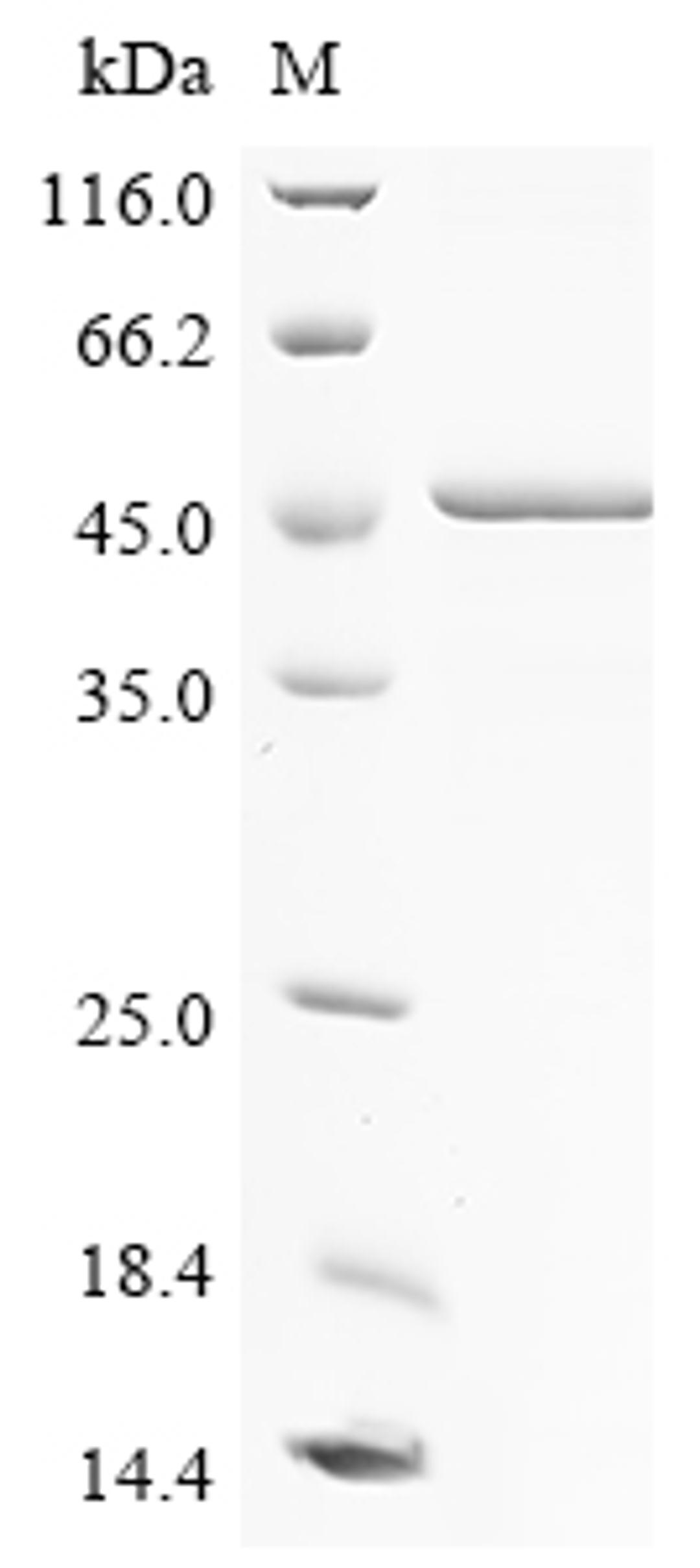 (Tris-Glycine gel) Discontinuous SDS-PAGE (reduced) with 5% enrichment gel and 15% separation gel.