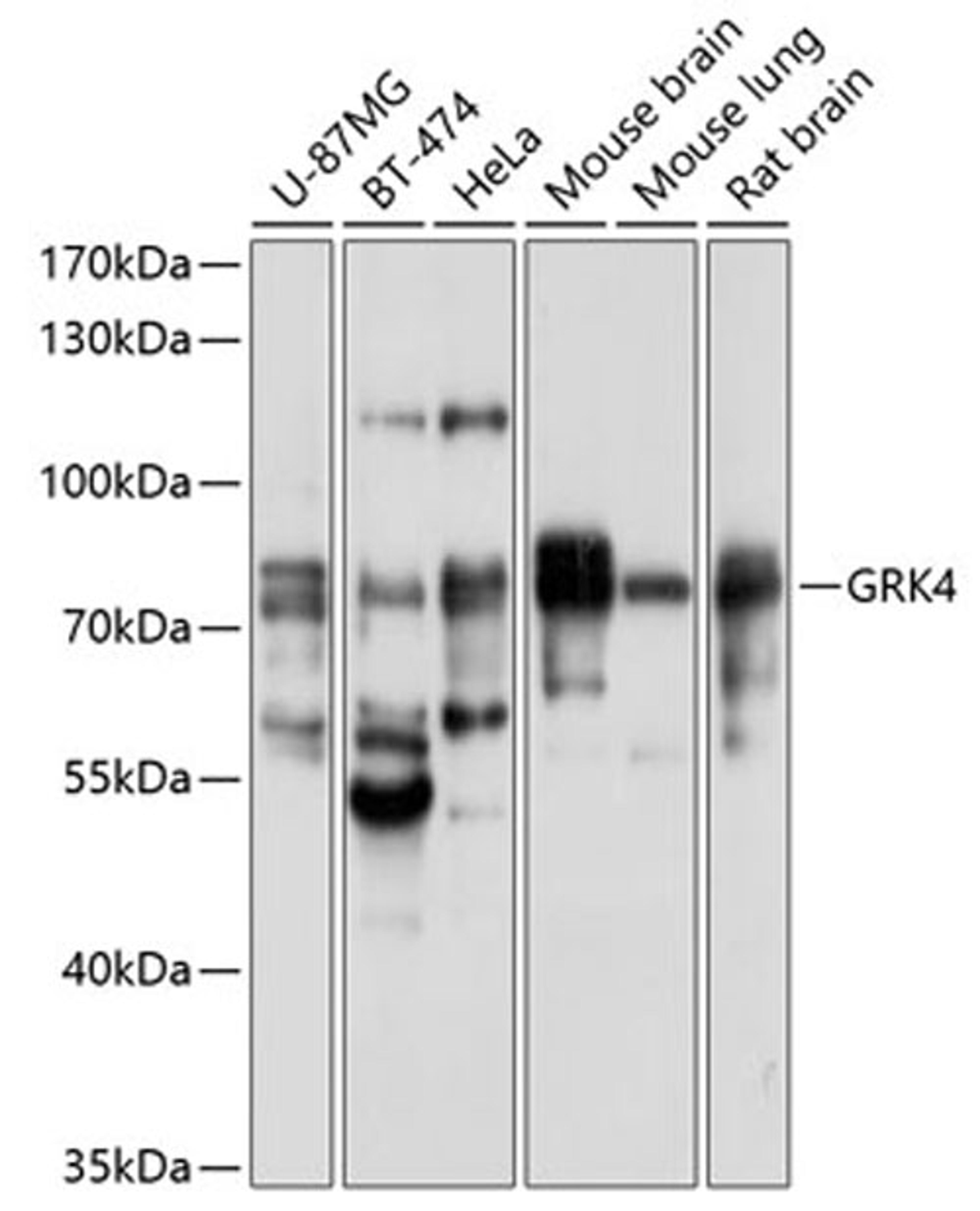 Western blot - GRK4 antibody (A10370)