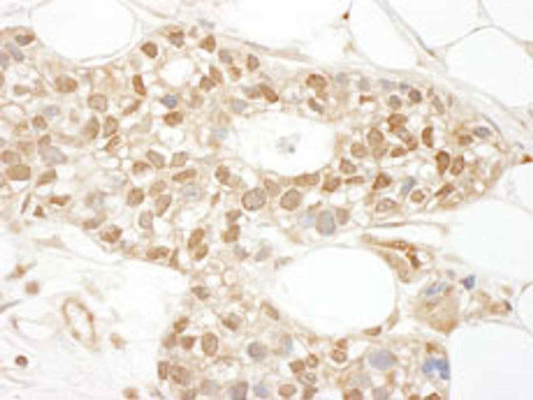 Detection of human MKL1 by immunohistochemistry.