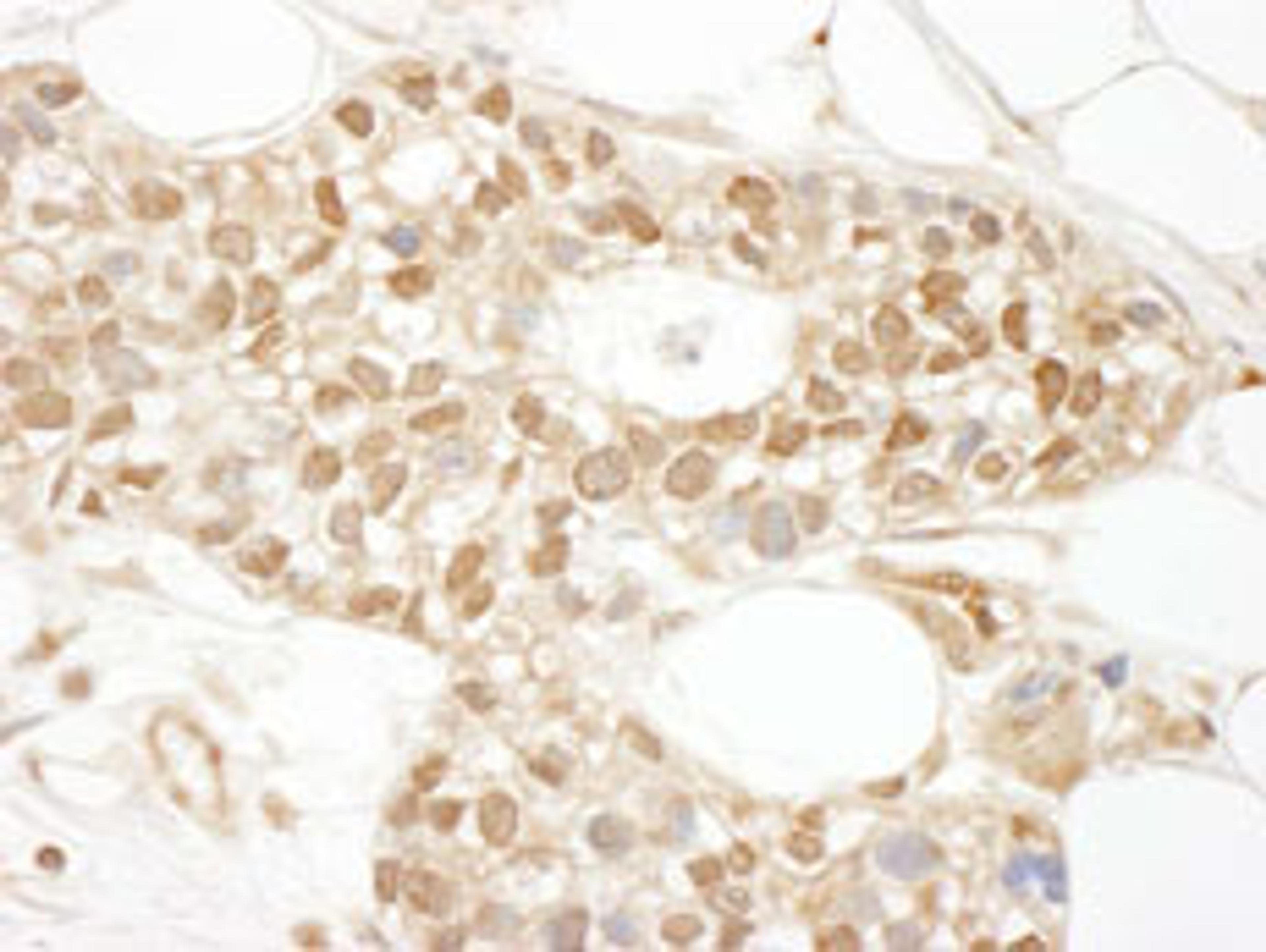 Detection of human MKL1 by immunohistochemistry.