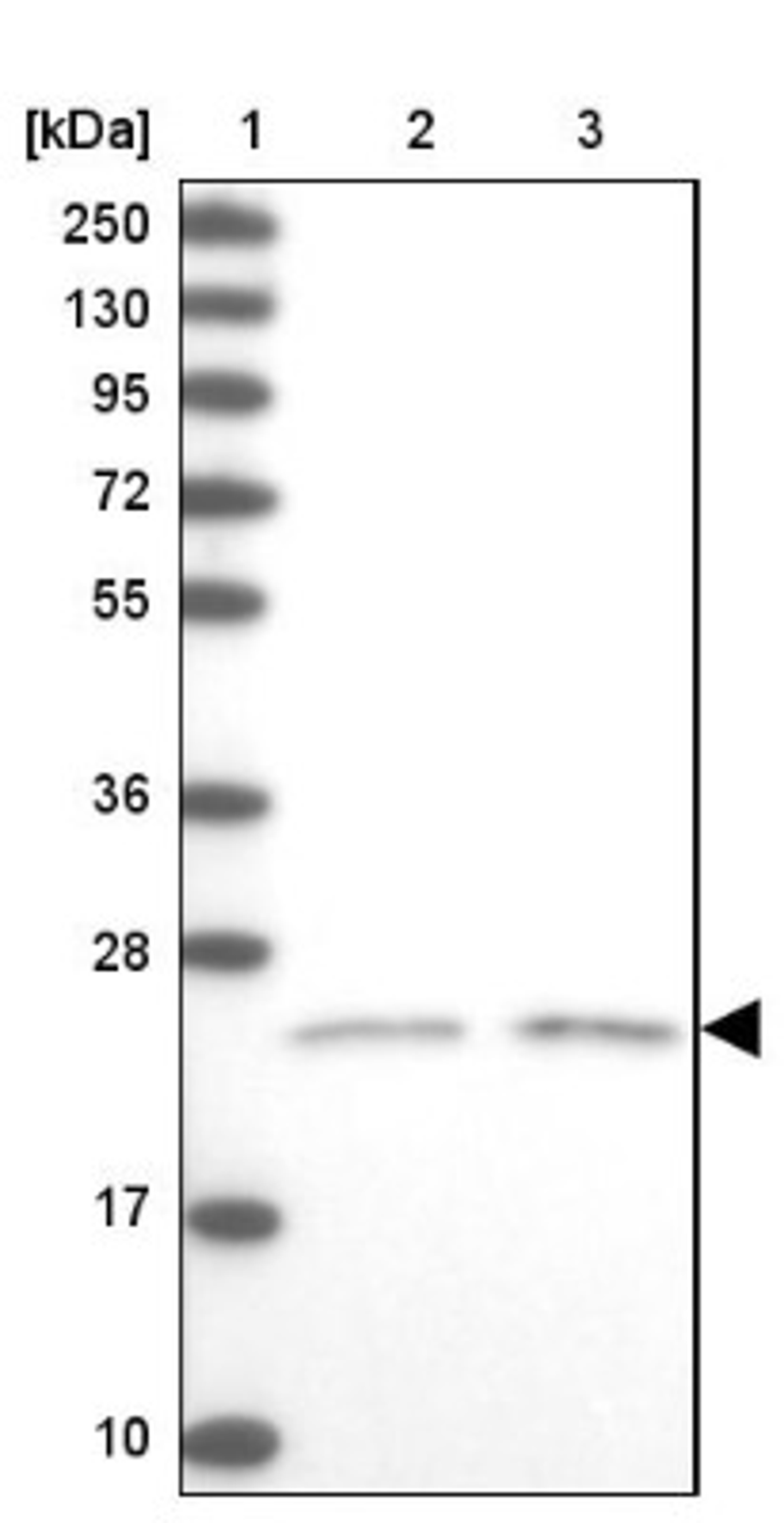 Western Blot: Kv6.1 Antibody [NBP1-81572] - Lane 1: Marker [kDa] 250, 130, 95, 72, 55, 36, 28, 17, 10<br/>Lane 2: Human cell line RT-4<br/>Lane 3: Human cell line U-251MG sp