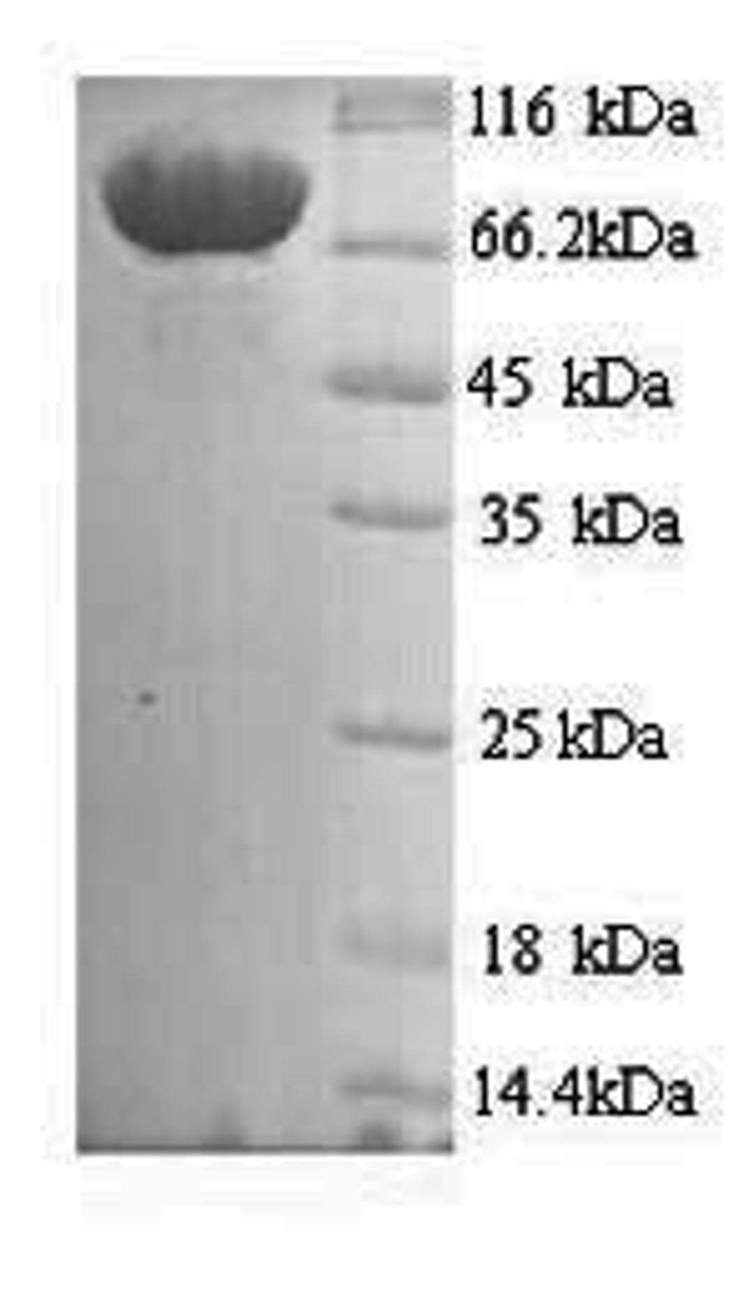 (Tris-Glycine gel) Discontinuous SDS-PAGE (reduced) with 5% enrichment gel and 15% separation gel.