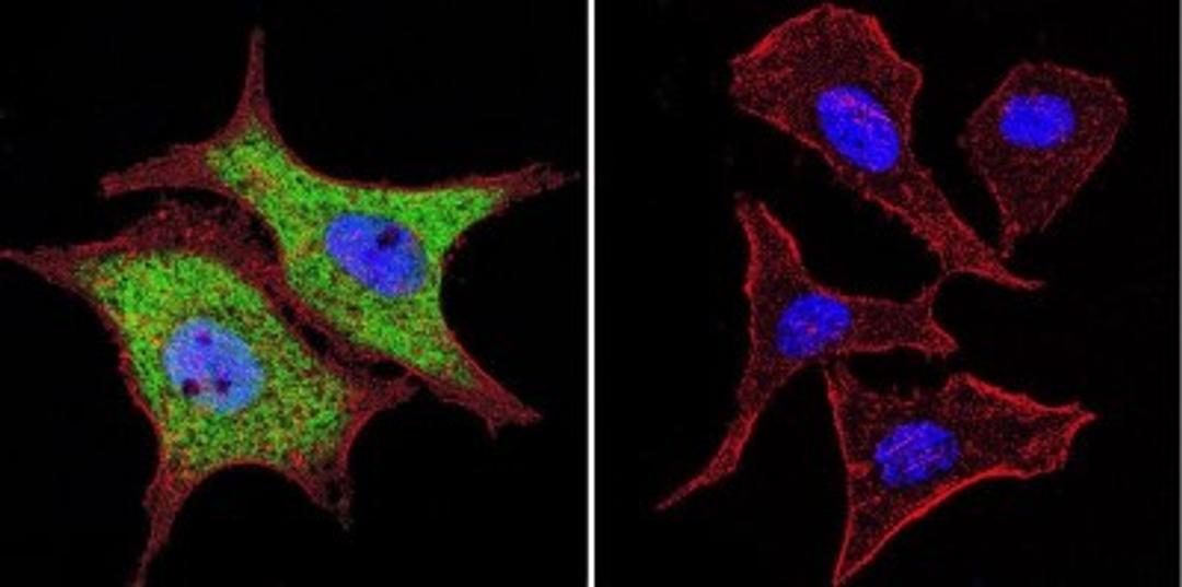 Immunocytochemistry/Immunofluorescence: p97/VCP Antibody (5) [NB120-11433] - Analysis of VCP using VCP Monoclonal antibody (5) shows staining in WiDr colon carcinoma cells. VCP staining (green), F-Actin staining with Phalloidin (red) and nuclei with DAPI (blue) is shown. Cells were grown on chamber slides and fixed with formaldehyde prior to staining. Cells were probed without (control) or with or an antibody recognizing VCP at a dilution of 1:20-1:200 over night at 4C, washed with PBS and incubated with a DyLight-488 conjugated.