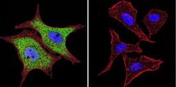 Immunocytochemistry/Immunofluorescence: p97/VCP Antibody (5) [NB120-11433] - Analysis of VCP using VCP Monoclonal antibody (5) shows staining in WiDr colon carcinoma cells. VCP staining (green), F-Actin staining with Phalloidin (red) and nuclei with DAPI (blue) is shown. Cells were grown on chamber slides and fixed with formaldehyde prior to staining. Cells were probed without (control) or with or an antibody recognizing VCP at a dilution of 1:20-1:200 over night at 4C, washed with PBS and incubated with a DyLight-488 conjugated.