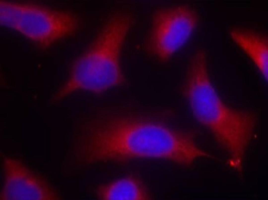 Immunocytochemistry/Immunofluorescence: Tau [p Ser262] Antibody [NB100-82242] - Staining of methanol-fixed Hela cells using Tau(Phospho-Ser262) antibody