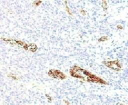 IHC testing of FFPE human pancreas and von Willebrand Factor antibody (WFA52-2).