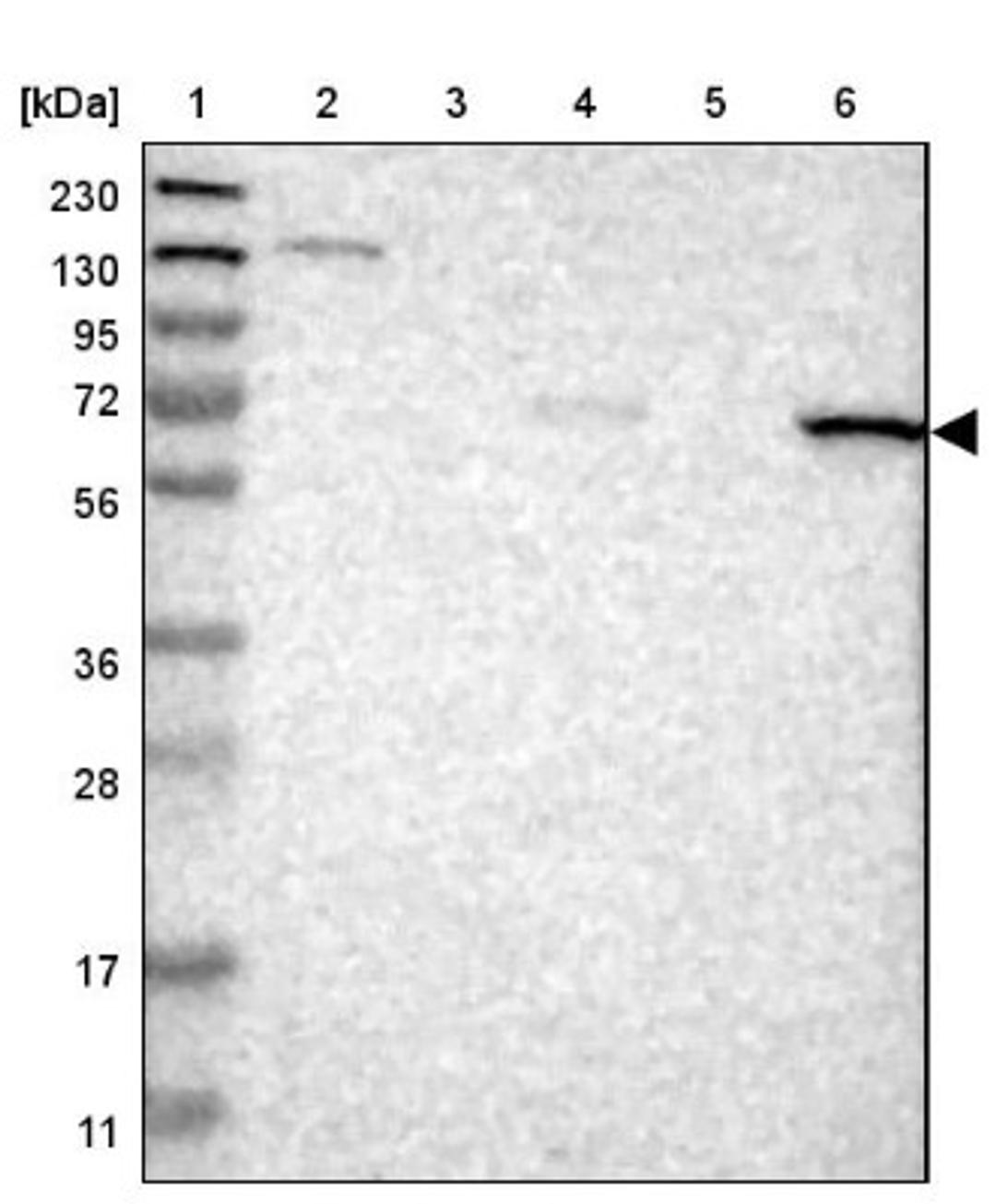 Western Blot: ANTXRL Antibody [NBP2-14488] - Lane 1: Marker [kDa] 230, 130, 95, 72, 56, 36, 28, 17, 11<br/>Lane 2: Human cell line RT-4<br/>Lane 3: Human cell line U-251MG sp<br/>Lane 4: Human plasma (IgG/HSA depleted)<br/>Lane 5: Human liver tissue<br/>Lane 6: Human tonsil tissue