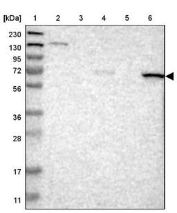 Western Blot: ANTXRL Antibody [NBP2-14488] - Lane 1: Marker [kDa] 230, 130, 95, 72, 56, 36, 28, 17, 11<br/>Lane 2: Human cell line RT-4<br/>Lane 3: Human cell line U-251MG sp<br/>Lane 4: Human plasma (IgG/HSA depleted)<br/>Lane 5: Human liver tissue<br/>Lane 6: Human tonsil tissue