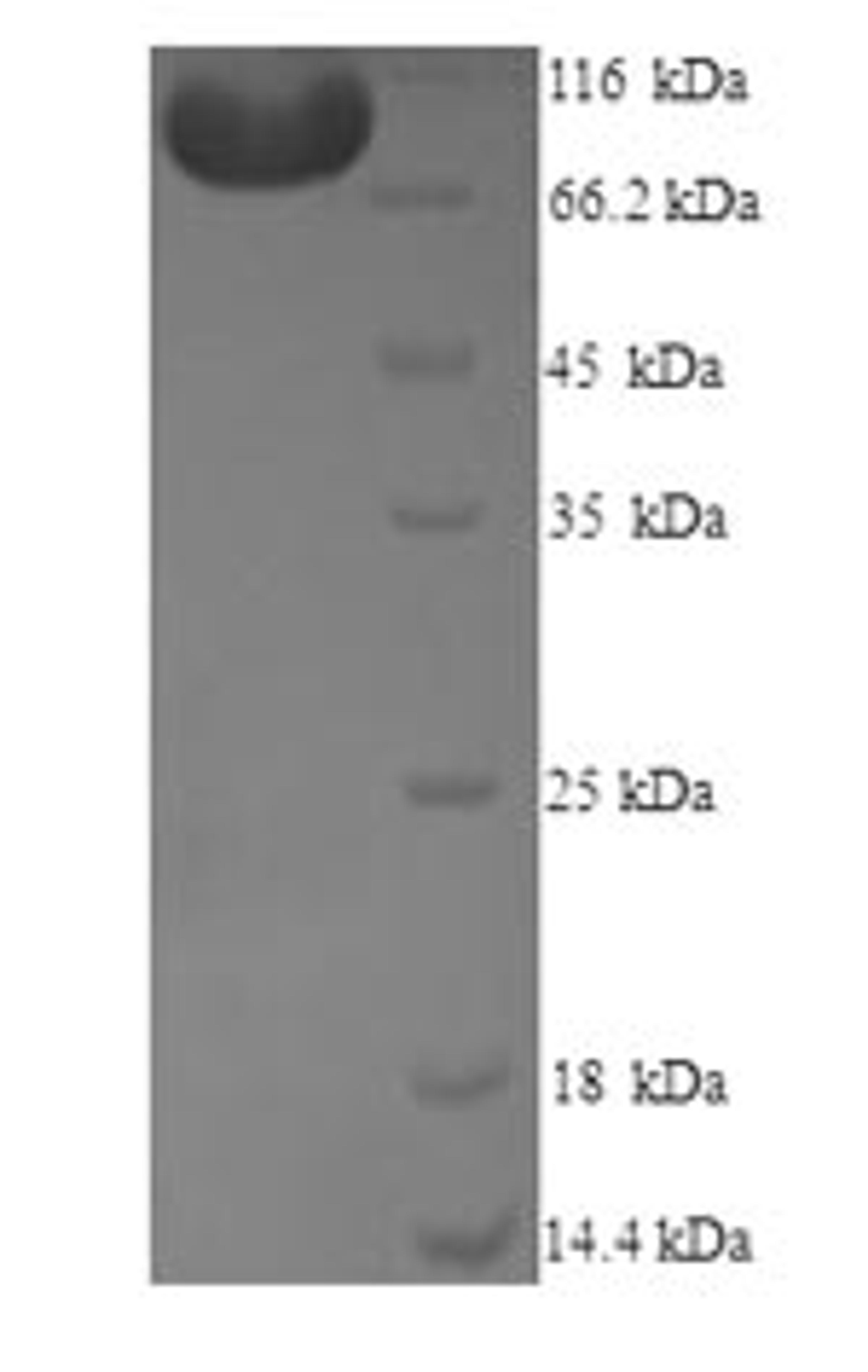 (Tris-Glycine gel) Discontinuous SDS-PAGE (reduced) with 5% enrichment gel and 15% separation gel.