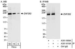 Detection of human ZNF262 by western blot and immunoprecipitation.