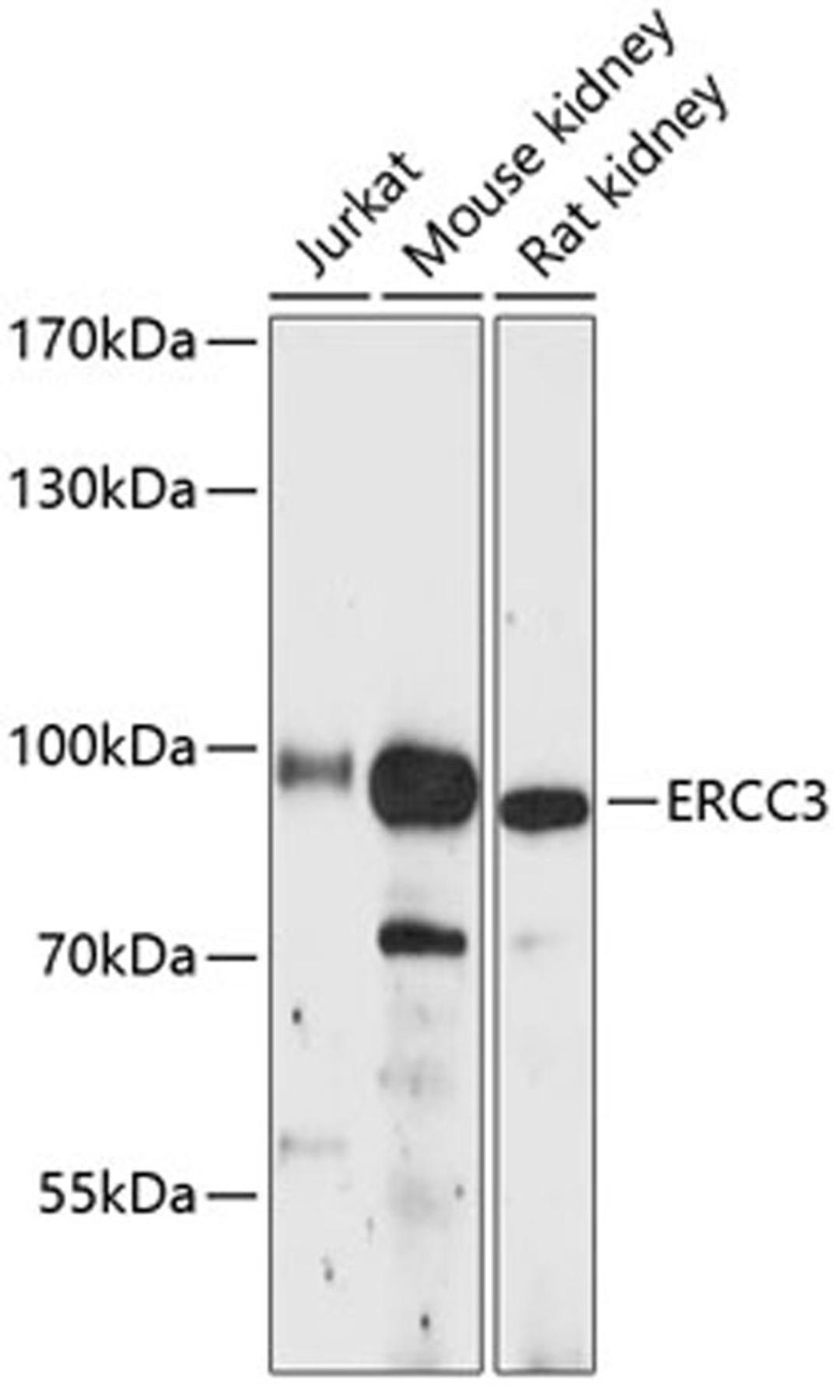 Western blot - ERCC3 antibody (A12702)