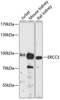 Western blot - ERCC3 antibody (A12702)