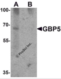 Western blot analysis of GBP5 in rat liver tissue lysate with GBP5 antibody at 1 &#956;g/mL in (A) the absence and (B) the presence of blocking peptide.