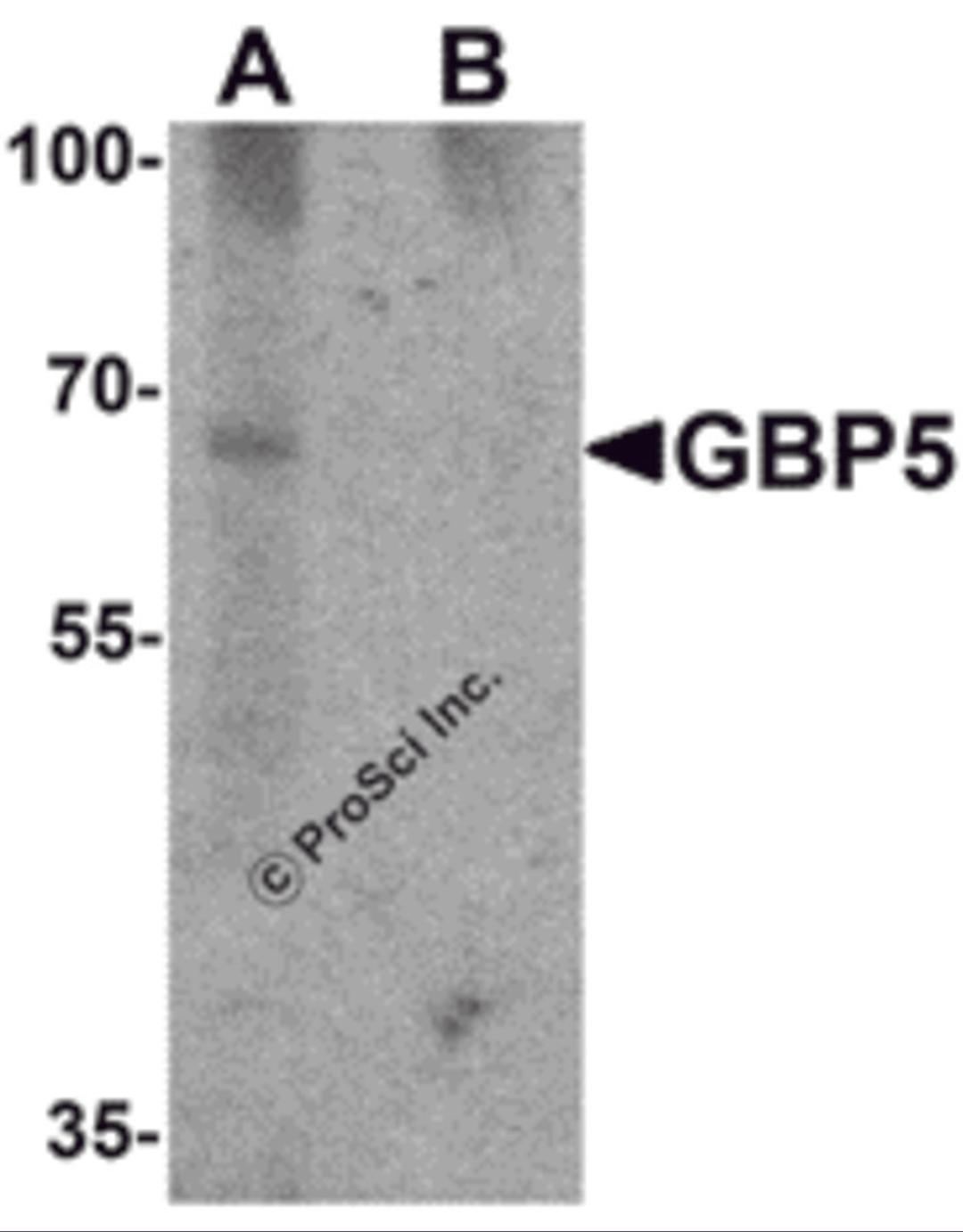 Western blot analysis of GBP5 in rat liver tissue lysate with GBP5 antibody at 1 μg/mL in (A) the absence and (B) the presence of blocking peptide.