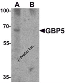Western blot analysis of GBP5 in rat liver tissue lysate with GBP5 antibody at 1 μg/mL in (A) the absence and (B) the presence of blocking peptide.