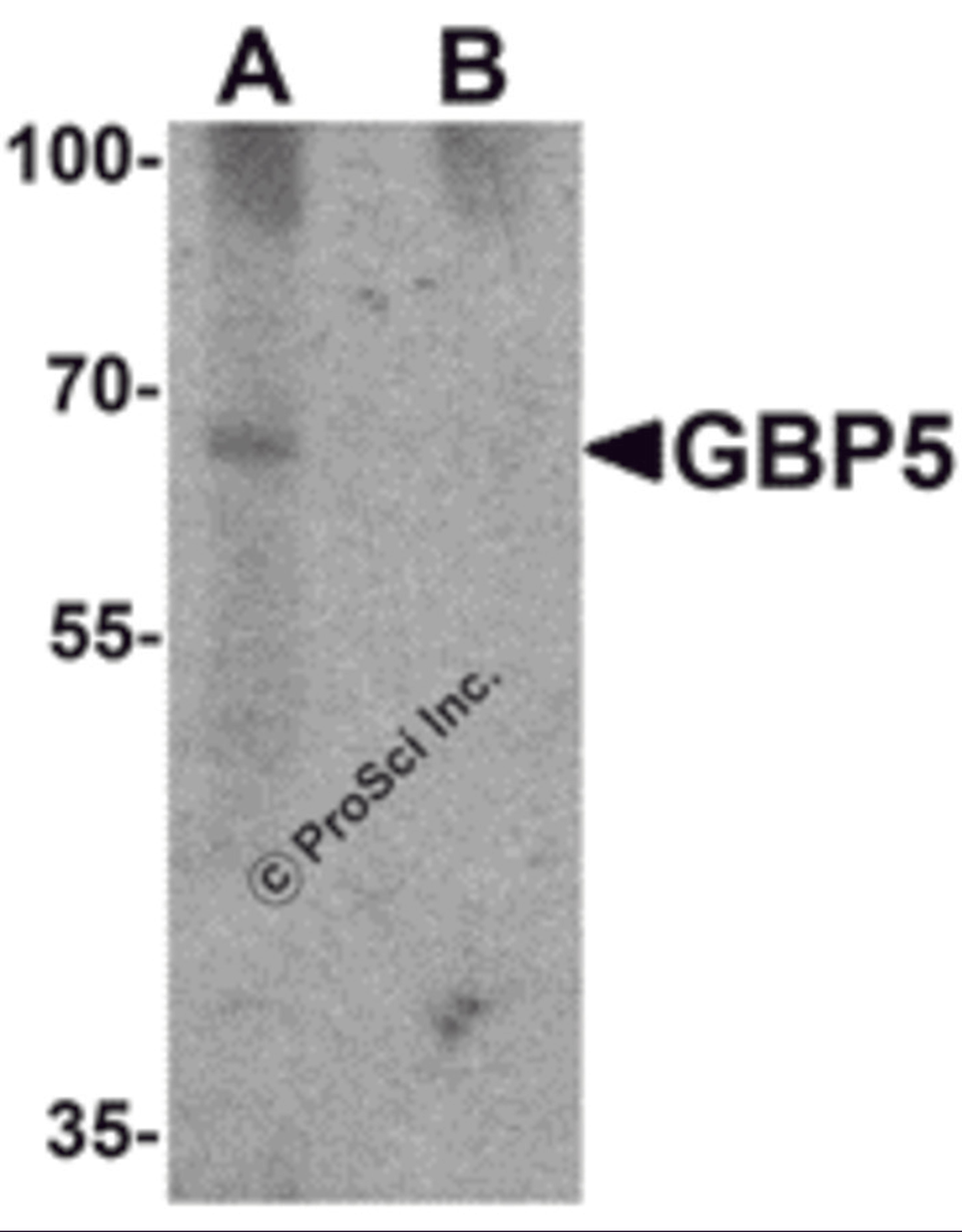 Western blot analysis of GBP5 in rat liver tissue lysate with GBP5 antibody at 1 μg/mL in (A) the absence and (B) the presence of blocking peptide.