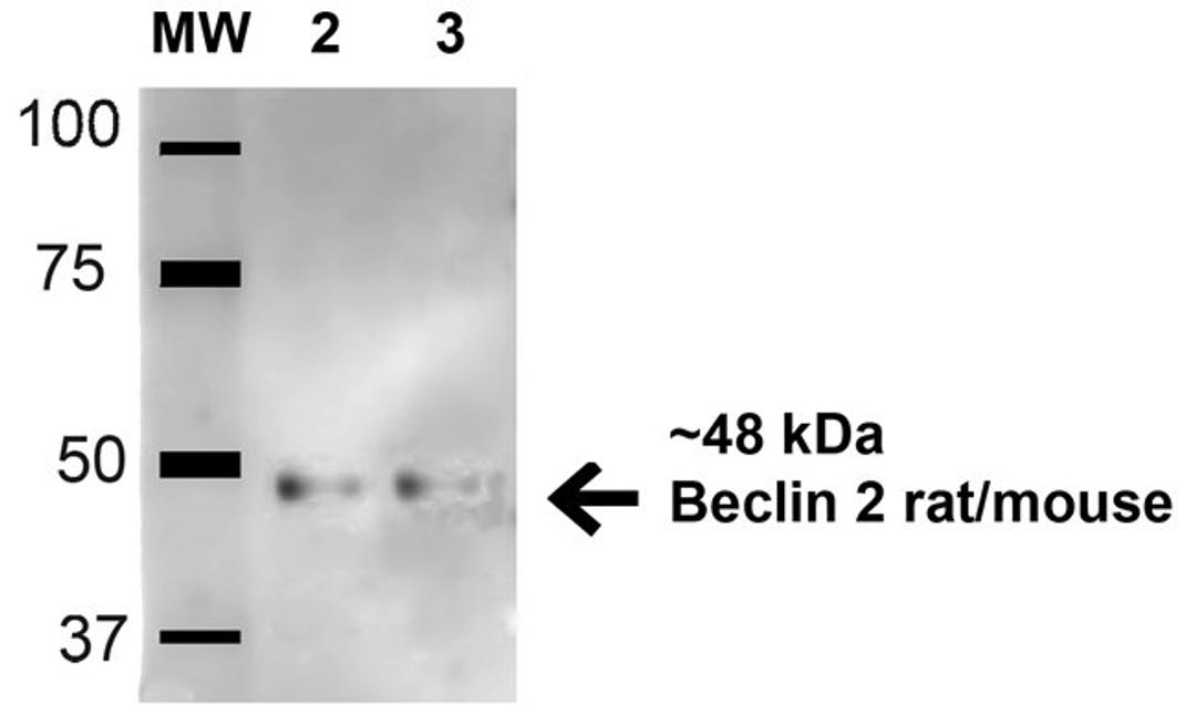 Western Blot analysis of human hela and 293trap cell lysates using Beclin 2 antibody