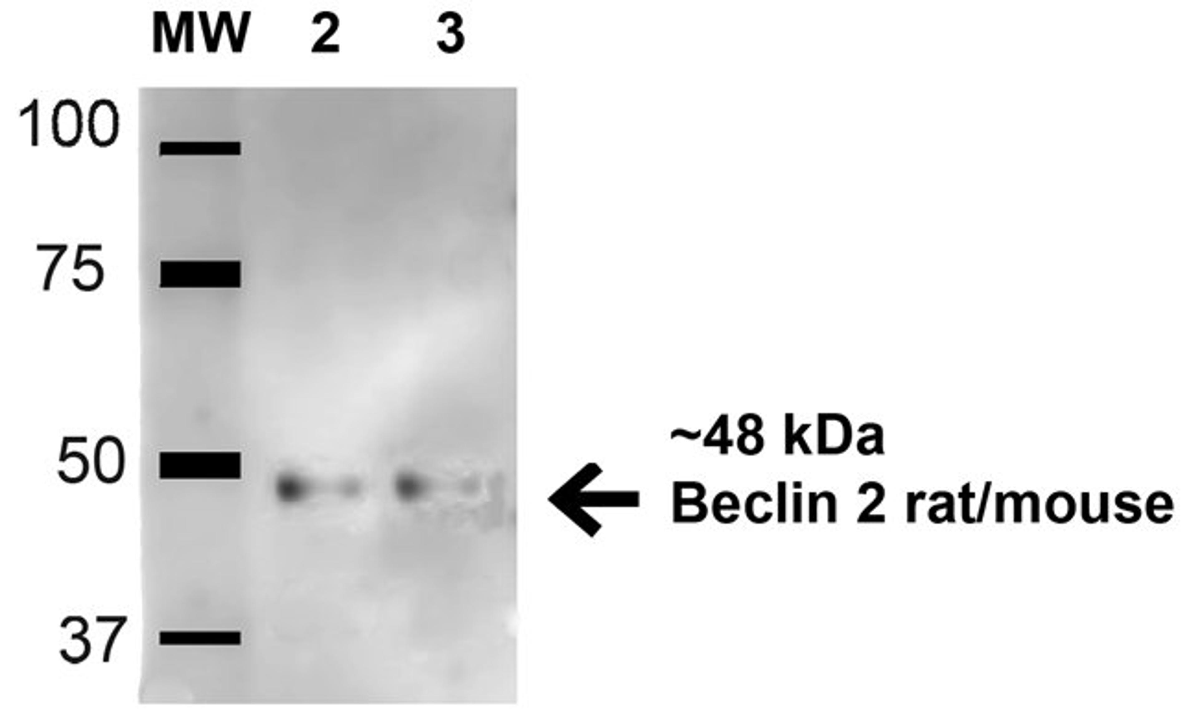 Western Blot analysis of human hela and 293trap cell lysates using Beclin 2 antibody