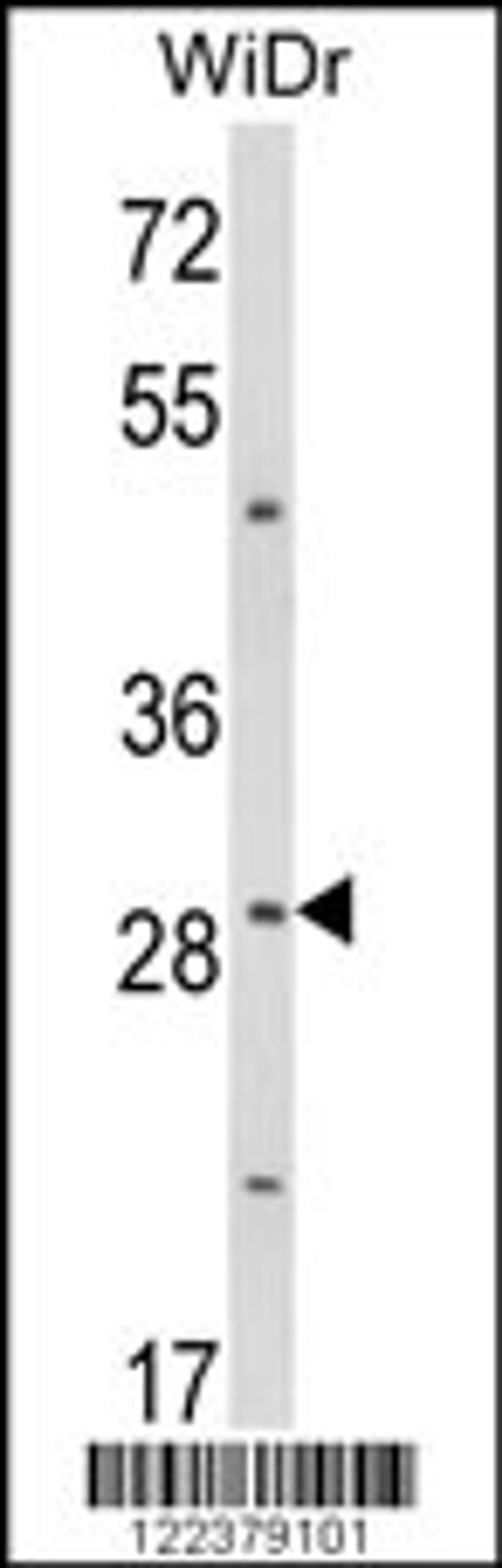 Western blot analysis of ZFP36 Antibody in WiDr cell line lysates (35ug/lane)