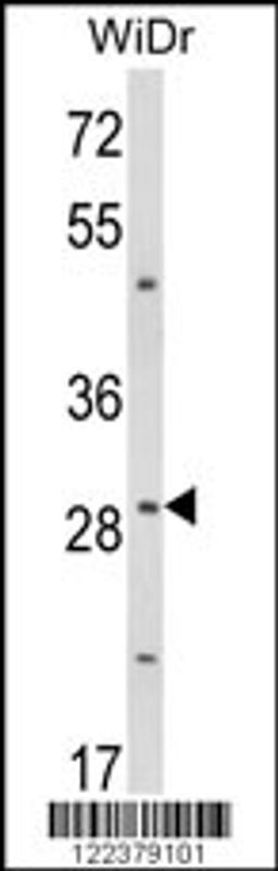 Western blot analysis of ZFP36 Antibody in WiDr cell line lysates (35ug/lane)