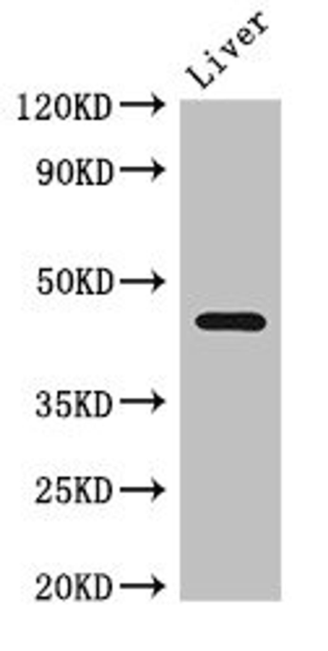 Western Blot. Positive WB detected in: Mouse liver tissue. All lanes: NGFR antibody at 2.7ug/ml. Secondary. Goat polyclonal to rabbit IgG at 1/50000 dilution. Predicted band size: 46, 36 kDa. Observed band size: 46 kDa.
