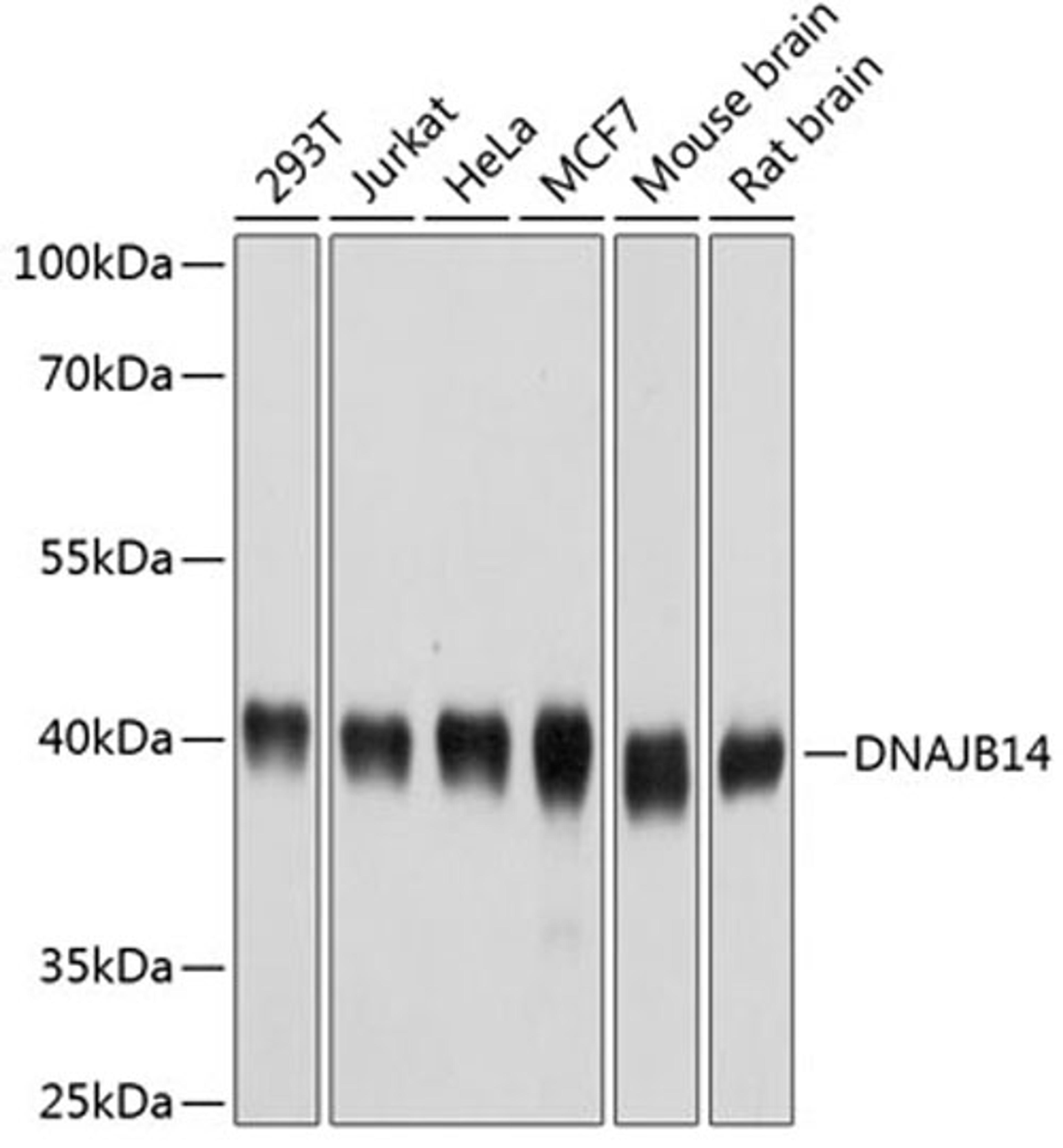 Western blot - DNAJB14 antibody (A4990)