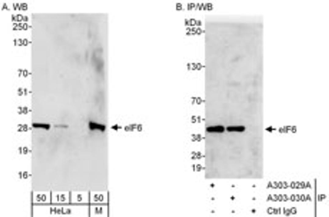 Detection of human and mouse eIF6 by western blot (h&m) and immunoprecipitation (h).