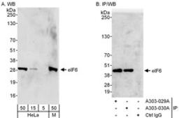 Detection of human and mouse eIF6 by western blot (h&m) and immunoprecipitation (h).