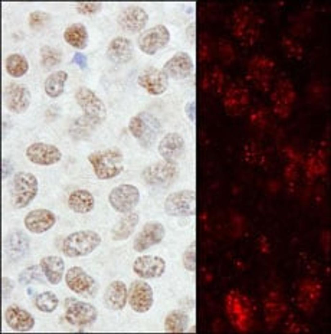 Detection of human ZNF295 by immunohistochemistry.