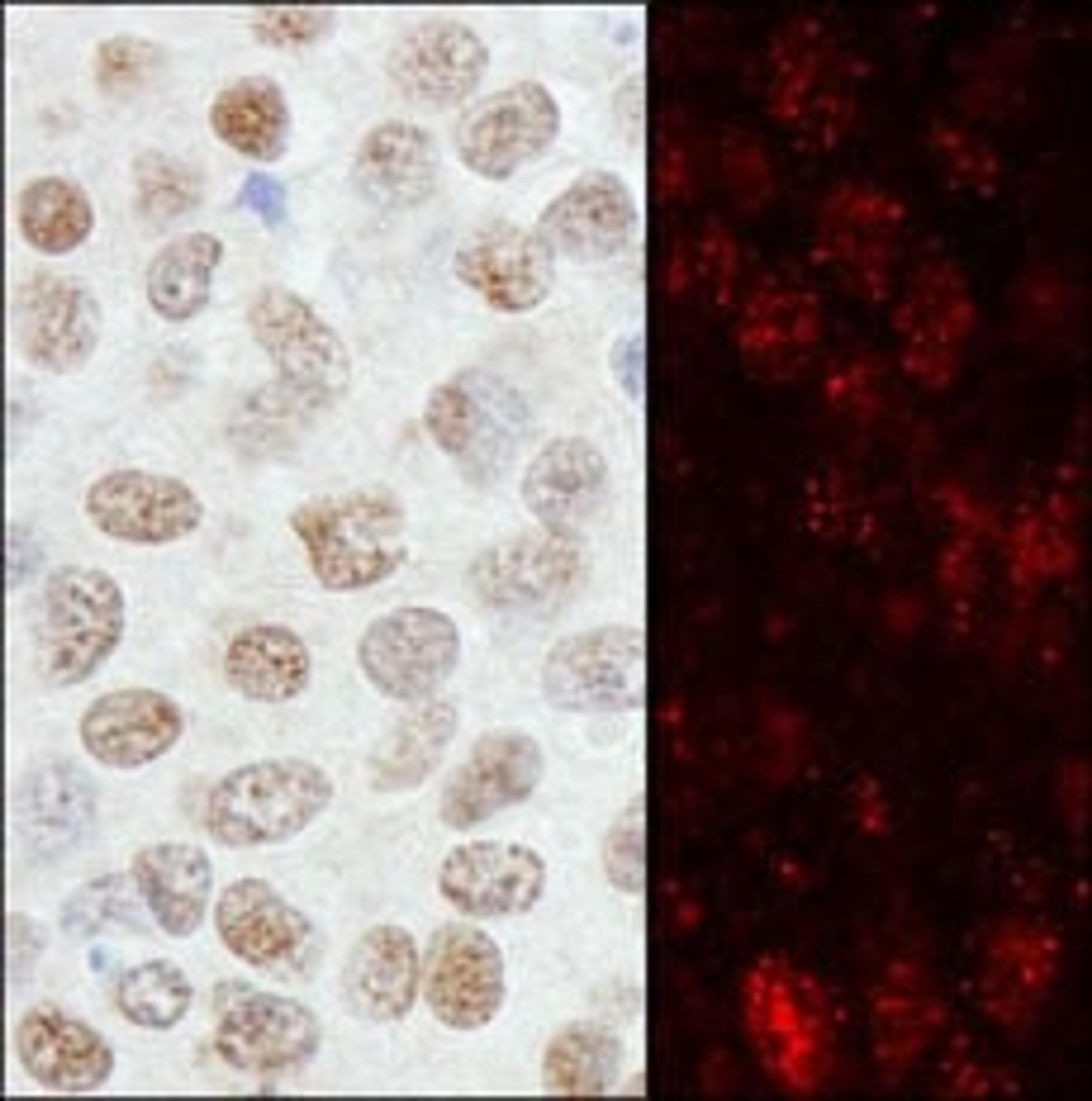 Detection of human ZNF295 by immunohistochemistry.