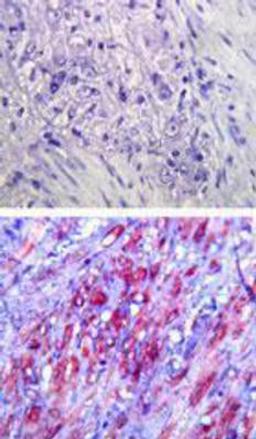 Immunohistochemistry-Paraffin: TLR4 Antibody (76B357.1) [NB100-56566] - Immunohistochemical analysis of TLR4 in paraffin-embedded formalin-fixed human colon tissue using an isotype control (top) and NB100-56566 (bottom) at 5 ug/ml.